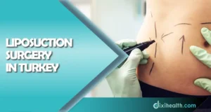 liposuction surgery in istanbul turkey