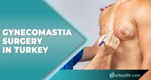 gynecomastia surgery in istanbul turkey