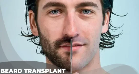 beard transplant cost in turkey