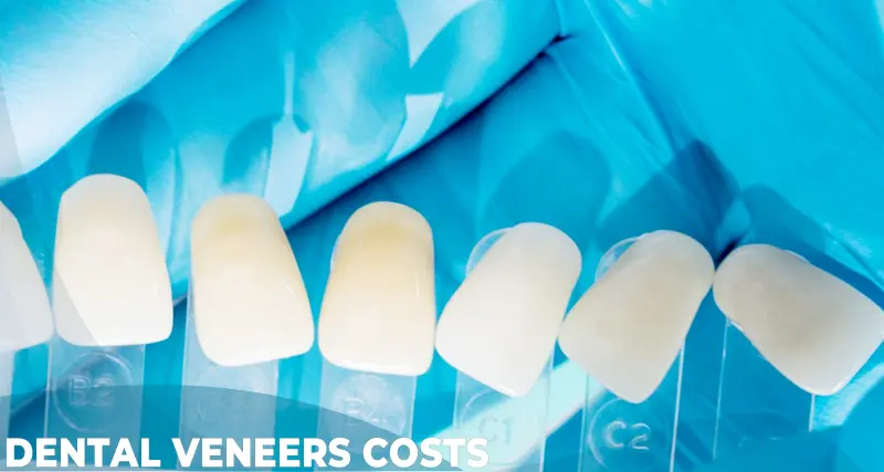 dental veneers cost and price