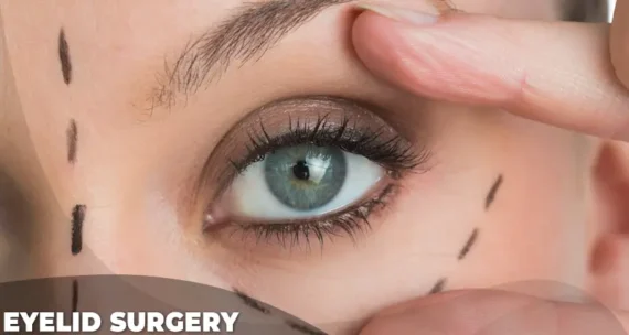 eyelid surgery costs
