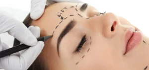 27 eyebrow lift turkey istanbul price eyebrow lift turkey istanbul price